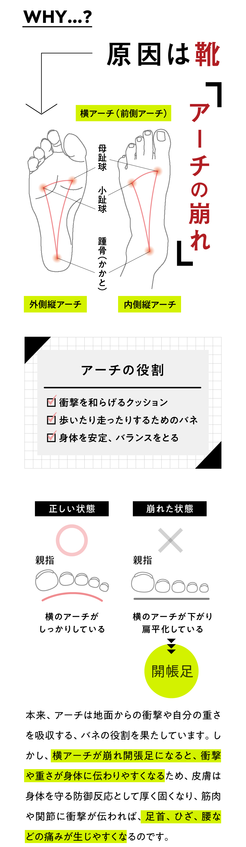 アーチが崩れ開帳足になるため痛みが生じやすくなる