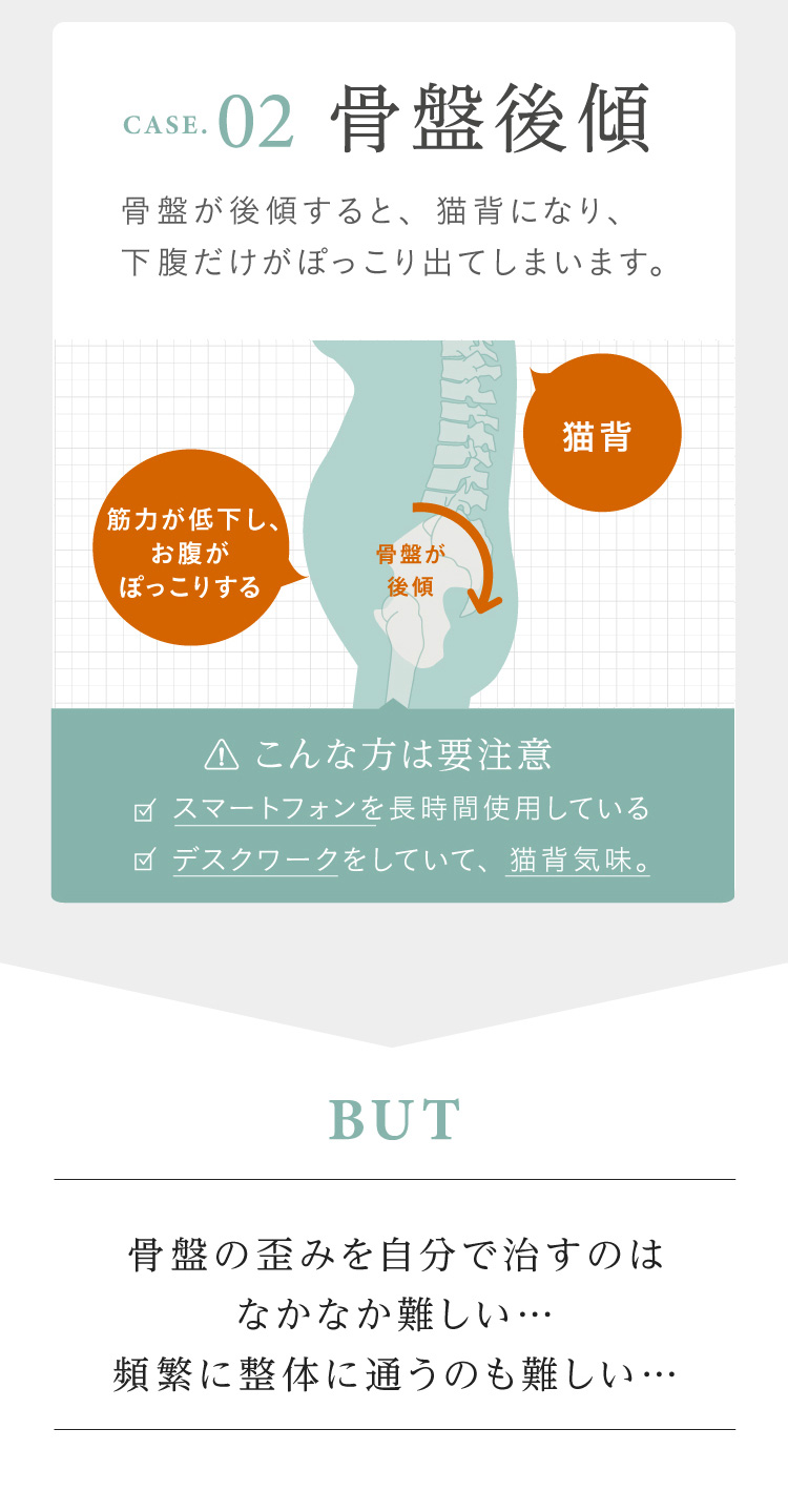 02　骨盤後傾　骨盤が後値すると、猫背になり、下腹だけがぽっこり出てしまいます。BUT　骨盤の歪みを自分で治すのはなかなか難しい…頻繁に整体に通うのも難しい…
