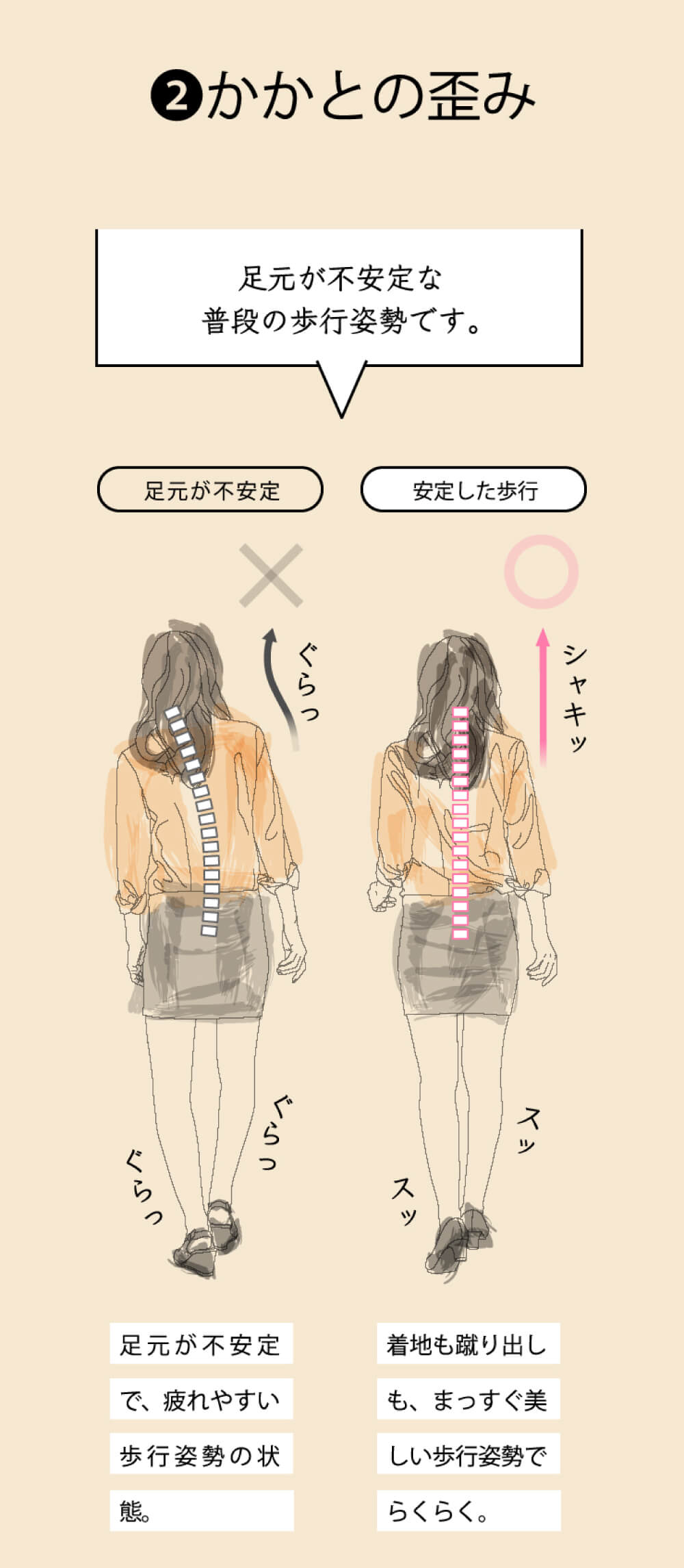かかとの歪み