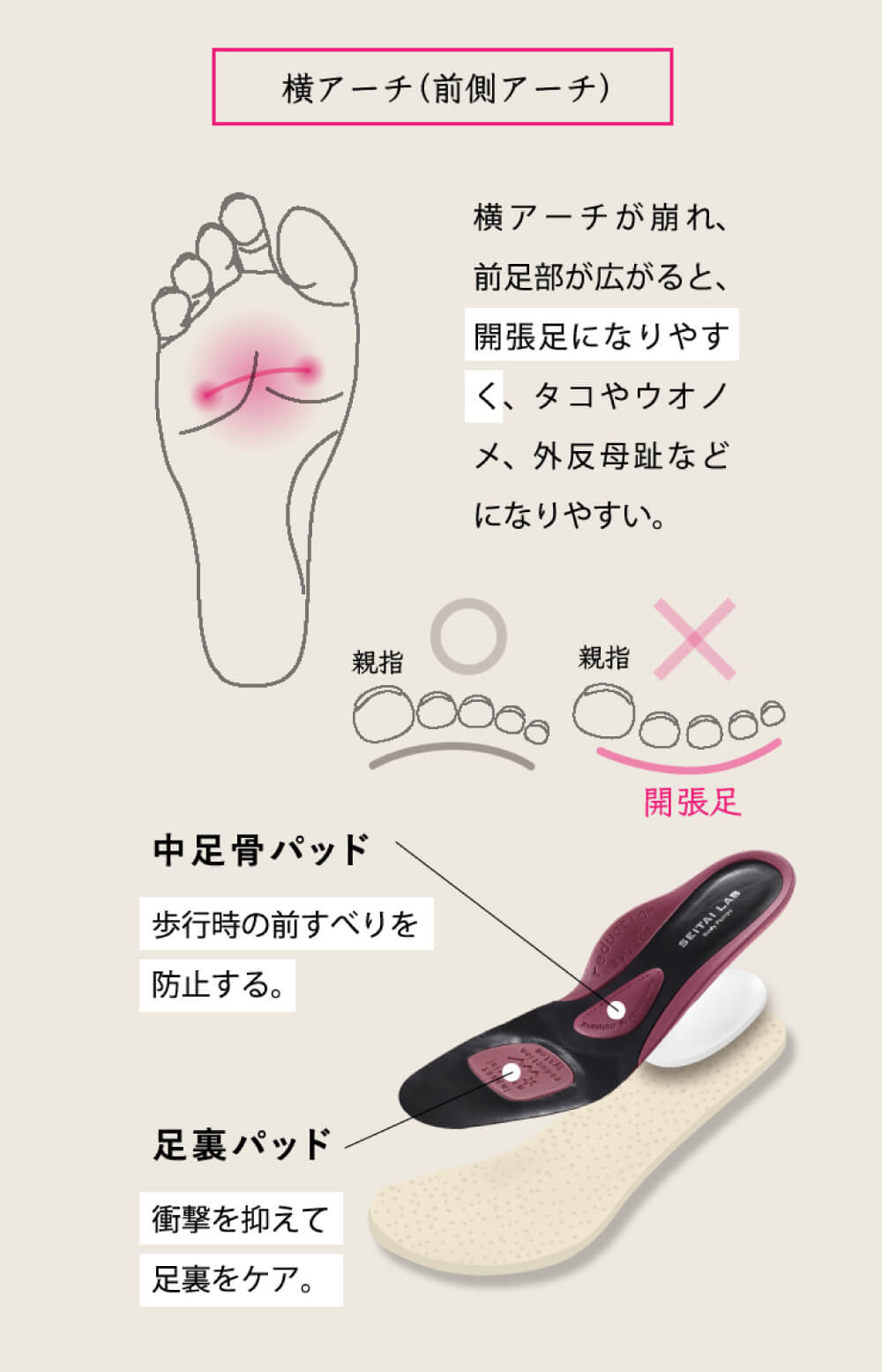 横アーチ