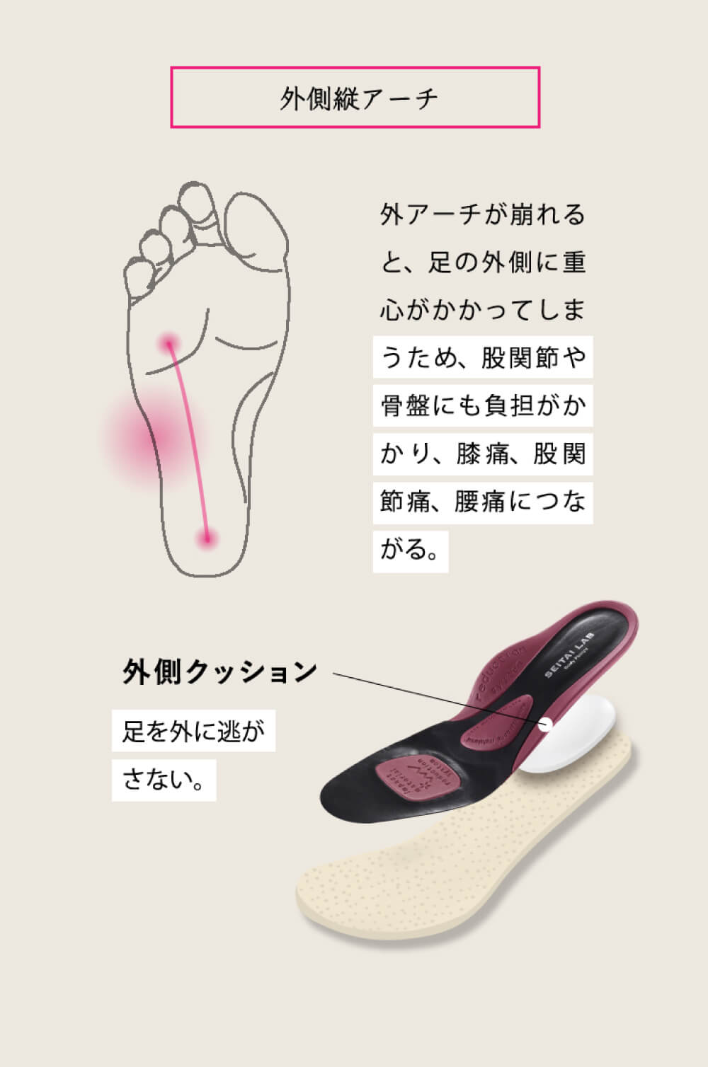 外側縦アーチ