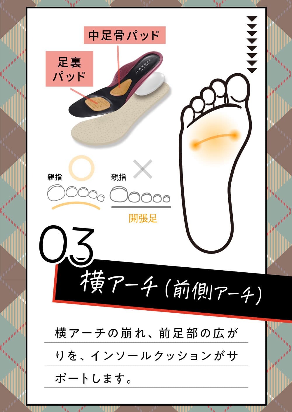 横アーチ
