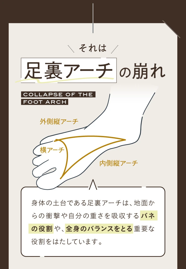 それは足裏アーチの崩れ