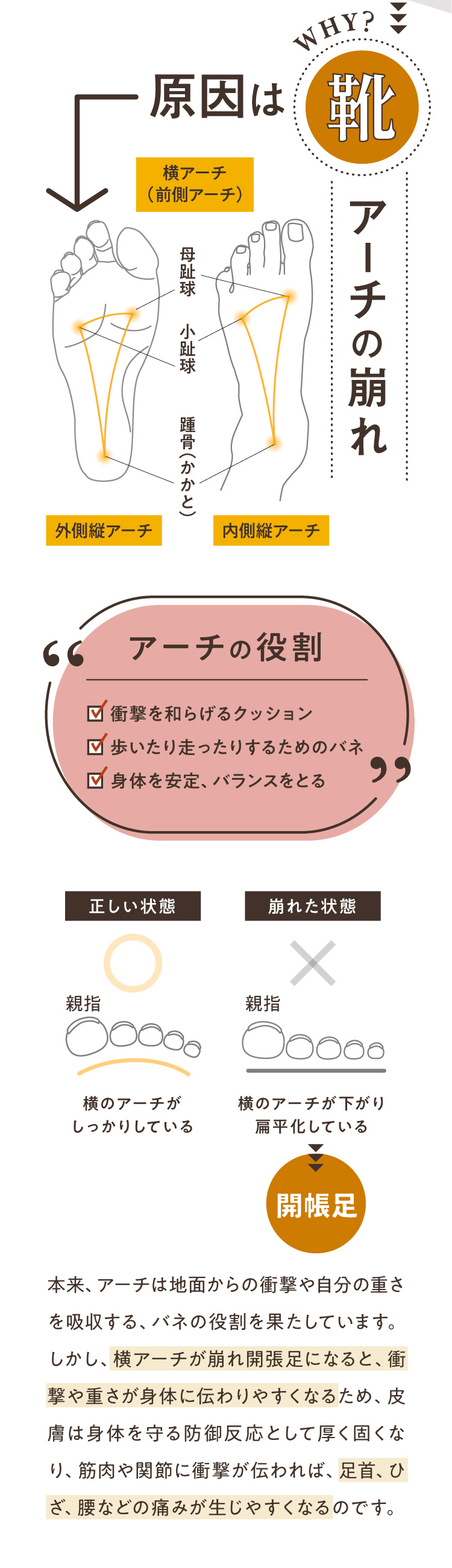 原因は靴　アーチの崩れ