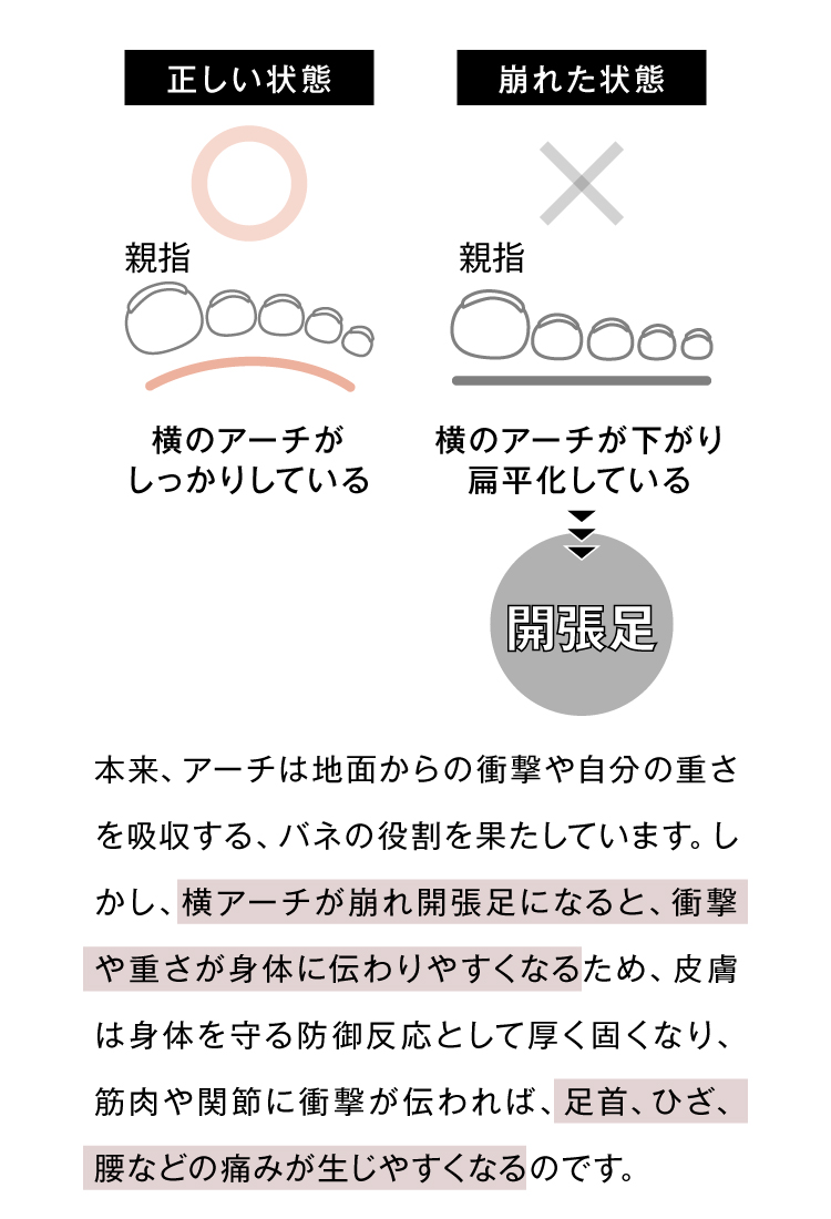 本来、アーチは地面からの衝撃や自分の重さを吸収する、バネの役割を果たしています。しかし、横アーチが崩れ開張足になると、衝撃や重さが身体に伝わりやすくなるため、皮膚は身体を守る防御反応として厚く固くなり、筋肉や関節に衝撃が伝われば、足首、ひざ、腰などの痛みが生じやすくなるのです。