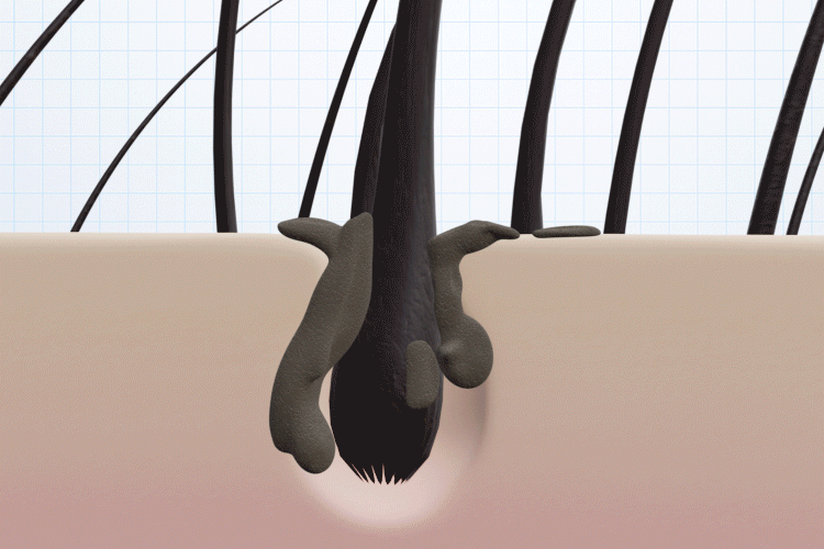 電子が毛穴に入り込んで汚れにアプローチ イメージgif