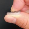 マウスピース　アップ
